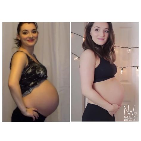 Mom Shares Stunning Comparison Of Baby Bump With Twins Vs. One Baby Twin Bump Progression, Small Baby Bump, Bump Progression, Twin Belly, Baby Bump Progression, 29 Weeks Pregnant, Pregnancy Videos, Pregnancy Progression, Bump Pictures