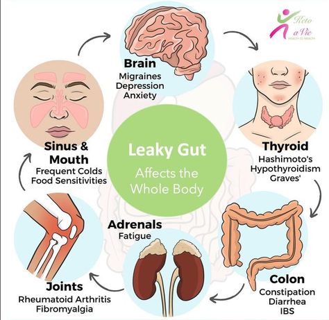 Keto A Vie on Instagram: "9 Leaky Gut Symptoms Problems in our gastrointestinal (GI) tract can cause more than just stomach pain 😥, gas 🤢, bloating, or diarrhea; they can be the root cause of many chronic health problems. If your intestinal wall has been compromised, and you have leaky gut, you’ll likely experience these symptoms and signs: 1. Digestive issues such as gas, bloating, diarrhea, or irritable bowel syndrome (IBS) 2. Food allergies 🤧 or food intolerances. 3. Brain fog 🧠 difficult Herbalife Aloe, Leaky Gut Symptoms, Gut Problems, Gut Brain, Digestive Issues, Gi Tract, Irritable Bowel, Food Intolerance, Seasonal Allergies