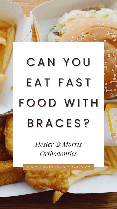 Blog post to answer those questions! Food With Braces, Food For Braces, Braces Food, Braces Tips, Getting Braces, Cute Braces, Types Of Pizza, Cinnamon Twists, Food Types