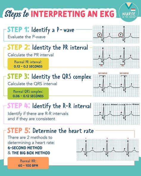 12 Lead Ekg Interpretation Made Easy, Ekg Interpretation Made Easy, Ekg Leads, Ekg Nursing, Ekg Tech, Ekg Rhythms, Nursing School Studying Cheat Sheets, Physician Assistant Student, Pharmacology Studying