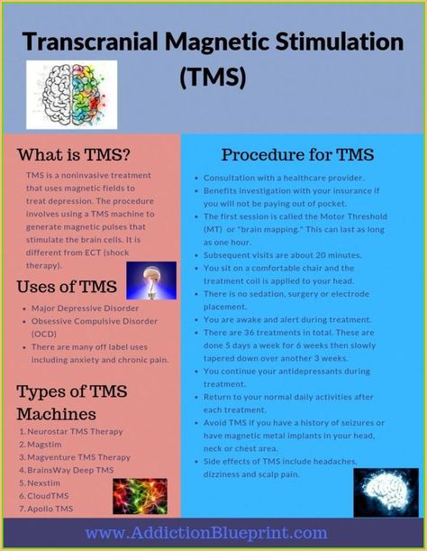 Stretch breaks, less stiffness. Tms Therapy, Transcranial Magnetic Stimulation, Magnet Therapy, Brain Mapping, Meditation Tips, Brain Stimulation, Brain Facts, Lower Back Pain Exercises, Pendulum Dowsing