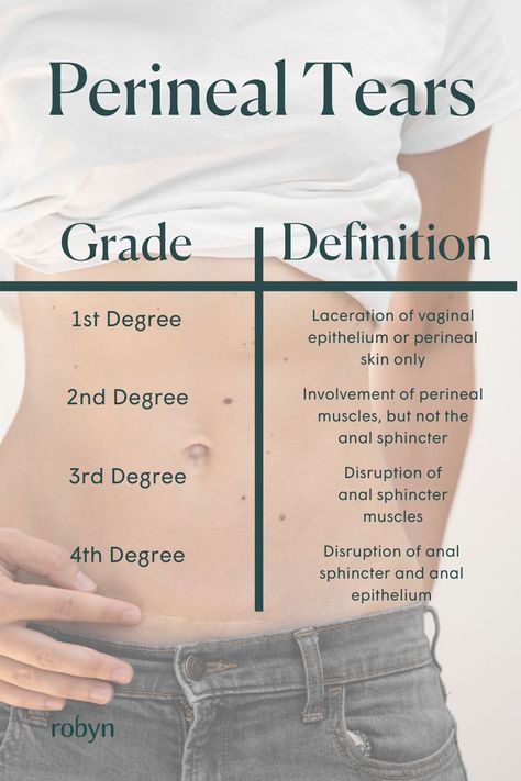 A grade 1 or grade 2 tear usually heals well. Grade 3 and 4 tears are larger, and may take longer to heal. These tears can result in pain, soreness, urination or fecal incontinence. However a grade 1 or 2 tear can also be painful. For more on postpartum recovery and the changes your body goes through, read the full article by Doctors of Physical Therapy @solsticephysicaltherapy Perineal Tear, Doctor Of Physical Therapy, Postpartum Care, Postpartum Recovery, Grade 2, Grade 3, Physical Therapy, New Parents, Postpartum