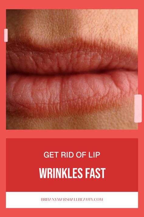 How to fix wrinkly lips with easy tips. Focusing on common causes like dehydration and aging as well as effective remedies using 1 image. Wrinkly Lips, Bigger Lips Naturally, Upper Lip Wrinkles, Bueaty Tips, Fuller Lips Naturally, Get Rid Of Wrinkles, Wrinkle Remedies, Plump Lips, Lip Wrinkles