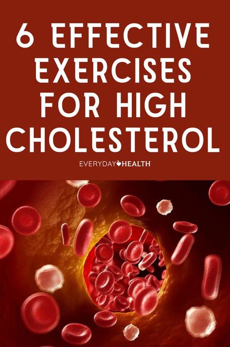 6 Effective Exercises for High Cholesterol Lower Cholesterol Exercise, How To Lower Hdl Cholesterol, How To Reverse High Cholesterol, How To Lower Colestral, Lower Cholesterol In 30 Days, What Helps Lower Cholesterol, How To Reduce Cholesterol Quickly, Exercise For High Cholesterol, Best Exercise To Lower Cholesterol