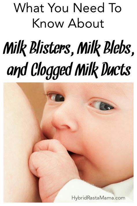 Do you have pain and soreness as a result of breastfeeding? Noticing some blister-like pimples on your nipples? Learn everything you need to know about milk blebs, milk blisters, and clogged milk ducts + how to get relief naturally from HybridRastaMama.com. She's had them ALL!! #milkblebs #nippleblisters #milkblisters #cloggedmilkducts #pluggedducts #mothersmilk #breastfeeding #sorebreasts Clogged Milk Duct Remedies, Milk Duct Clog, Milk Blister, Clogged Milk Duct, Blood Blister, Clogged Duct, Holistic Pet Care, Mother Milk, Herbal Healing