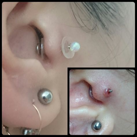 Have scarring (dreaded piercing bump?) maybe you even have it on both sides. Install NoPull Piercing Disc™ on both sides of the piercing, with gentle, but direct contact. It’s the silicone! www.NoPullPiercing.com How To Get Rid Of Piercing Bumps, How To Get Rid Of Piercing Bumps Fast, How To Get Rid Of A Piercing Bump, Irritation Bumps Piercing, Piercing Healing, Nose Piercing Bump, Piercing Bump, Hypertrophic Scars, Constellation Piercings