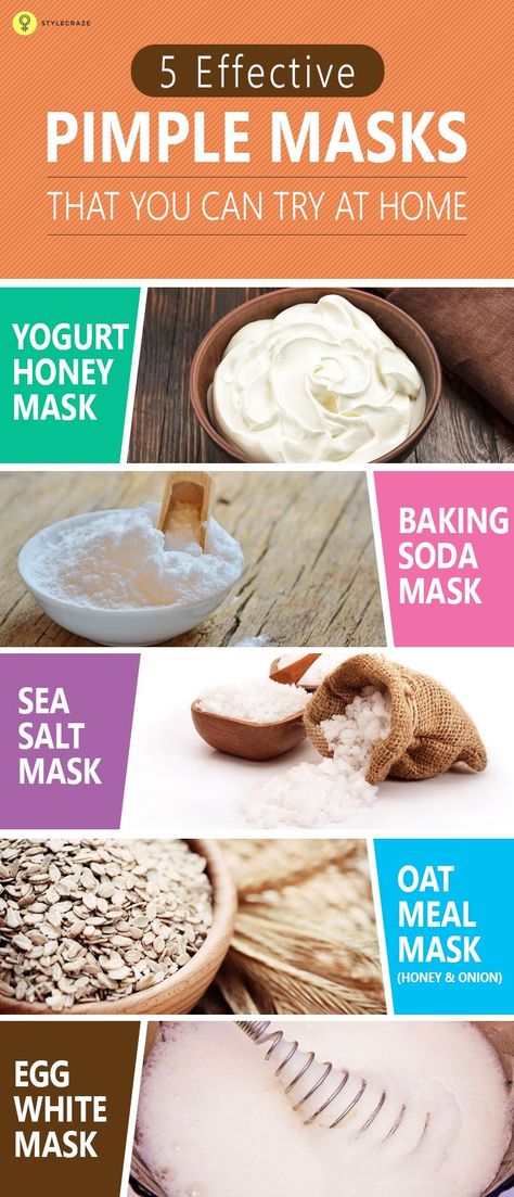 Many of us struggle through our teenage or even throughout our whole life mainly if we have oily skin , with this problem known as acne which is very common . But only a few knows that some effective easy to make home remedies can solve out or atleast lessen this problem and also do away with the spots that come with it Pimple Mask, Baking Soda Mask, Homemade Face Pack, Oily Skin Remedy, Tips For Oily Skin, Acne Free Skin, Skin Care Routine For 20s, Natural Acne Remedies, Face Scrub Homemade