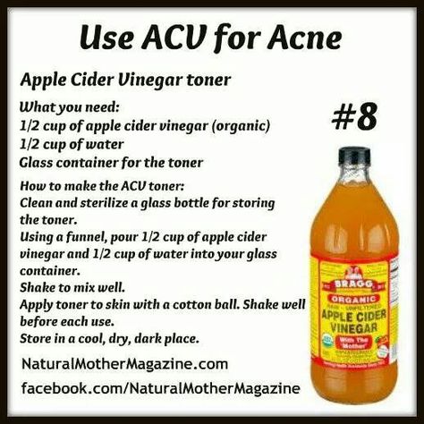 ACV facial toner Acv For Acne, Apple Cider Vinegar Toner, Apple Cider Vinegar Acne, Apple Cider Vinegar Uses, Apple Cider Vinegar For Skin, Apple Cider Benefits, Skin Remedies, Skin Care Remedies, Skin Cleanser Products