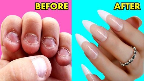 Nails Strengthener, Make Nails Grow, Making Nails, Grow Long Nails, Nail Growth Tips, Grow Nails Faster, Fast Nail, How To Grow Nails, Nail Growth