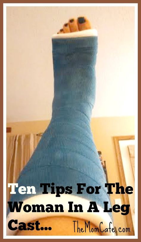 Workouts While In A Leg Cast, Leg In A Cast, Leg Cast Outfit Ideas, Cast Ideas Leg, Lisfranc Injury Recovery, Non Weight Bearing Tips, Ankle Surgery Recovery Tips, Broken Ankle Recovery Tips, Trimalleolar Fracture