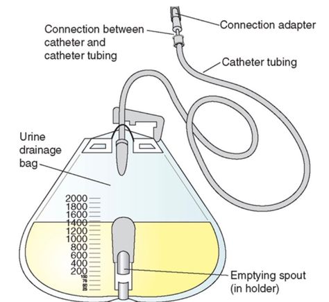 Urinary Catheterization, Urinary Bladder, Catheter Bag, Foley Catheter, Bag Supplies, Urinary System, Infection Prevention, Nursing School Studying, Infection Control