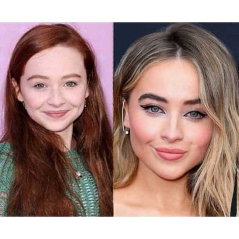 Nose Profile, Surgery Nose, Nose Job, After Photos, Sabrina Carpenter, Plastic Surgery, Surgery, Celebrity Style, Celebrities