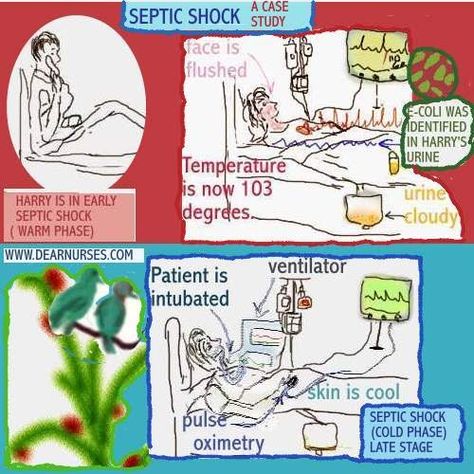 Septic Shock Nursing, Shock Nursing, Medical Diagrams, Med Surge, Nurse Girl, Nerdy Nurse, Septic Shock, Nursing Classes, Med Surg Nursing