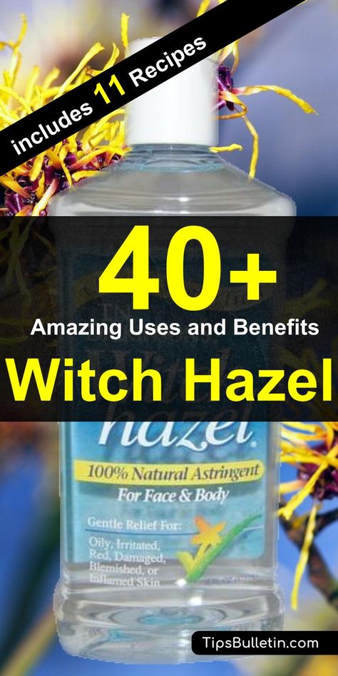 Witch Hazel For Acne, Witch Hazel Acne, Witch Hazel Uses, Acne Face, Diy Remedies, Face Beauty, Natural Therapy, Witch Hazel, Natural Home Remedies