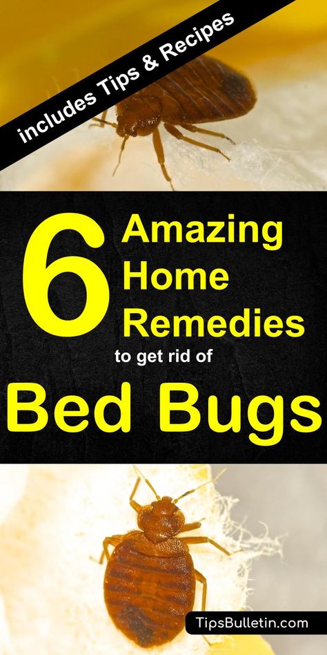 Have bed bugs? Want to keep them from living in your home without spending a fortune on an exterminator? Check out these quick home remedies for bed bugs. Bed Bug Remedies, Vinegar Baking Soda Cleaner, Baking Soda Cleaner, Get Rid Of Bed Bugs, Uses Of Baking Soda, Bed Bug Spray, Uses For Baking Soda, Arm And Hammer Baking Soda, Kill Bed Bugs