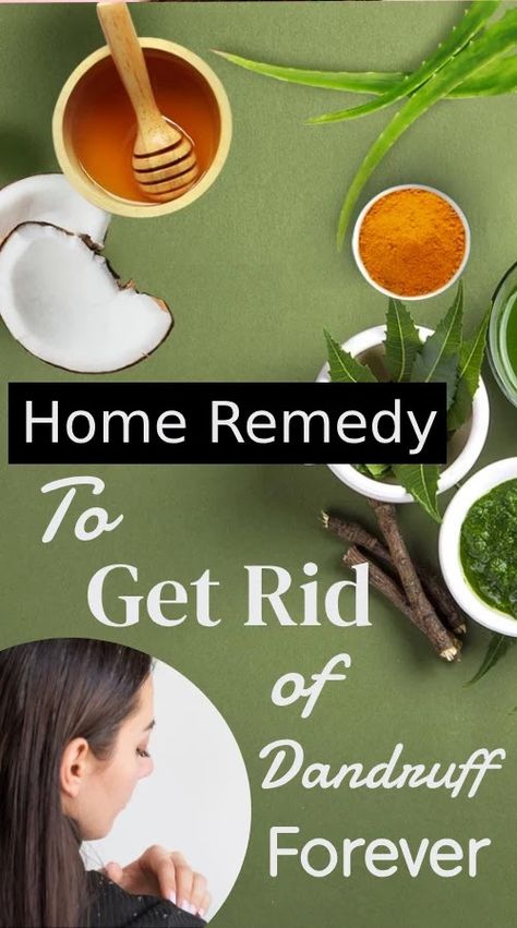 Aloe Vera For Sunburn, Home Remedies For Dandruff, Dandruff Solutions, Home Remedies For Allergies, Rid Of Dandruff, Fresh Aloe Vera Gel, Dandruff Remedy, Dry Skincare, Natural Remedies For Migraines