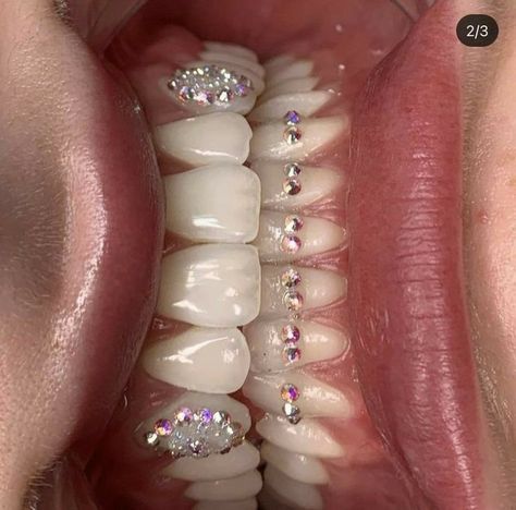 Tooth Gems Ideas Men, Gems On Teeth, Tooth Piercing, Tooth Gems Aesthetic, Tooth Gems Ideas, Teeth Bling, Tooth Jewel, Teeth Gems, Pretty Teeth