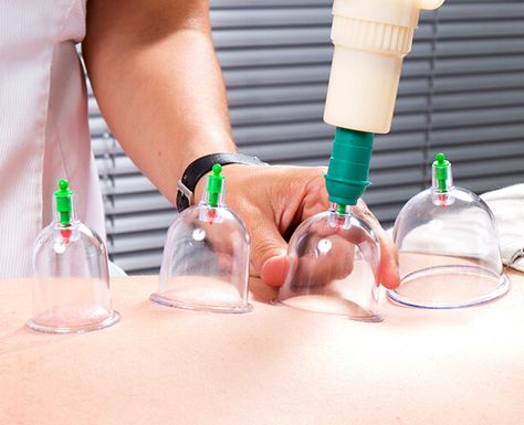 Hijama Cupping Therapy Logo, Cupping Therapy Logo, Dry Cupping Therapy, Bekam Sunnah, Taim Hassan, Hijama Points, What Is Cupping Therapy, Cupping Points, Body Points