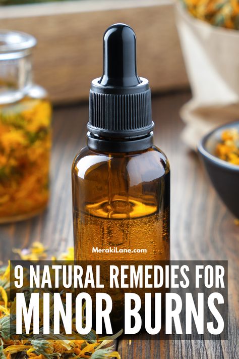 9 Home Remedies for Minor Burns and Scalds | Whether you've touched a curling iron, put your hand on a hot stovetop, or have a sunburn, it's helpful to have some burn treatments on hand, so save this pin! We're sharing a list of natural remedies & tips to treat burns using items you probably already have on hand like honey, cold compresses, and homemade calendula salves or ointments. We're also sharing tips to prevent burns and scalds, and when to seek medial help. Burn Remedy Hand, What To Put On Burns On Skin, Curling Iron Burn, Home Remedies For Burns, 2nd Degree Burns, Burn Remedy, Health Remedy, Burn Care, Treat Burns