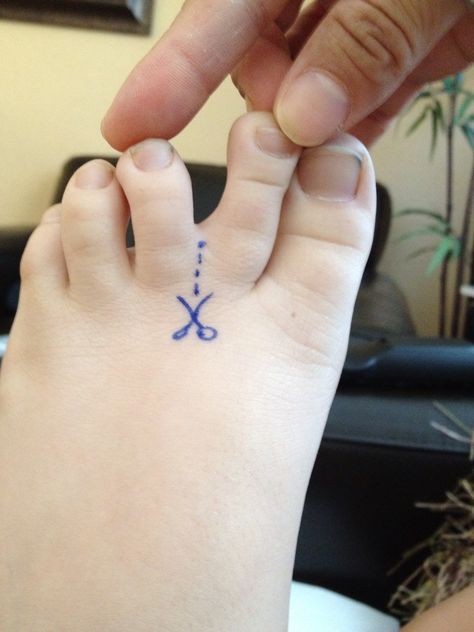 Web-toes detach idea. Detach Tattoo, Really Bad Tattoos, Bad Tattoos, Gone Wrong, Tattoo Artist, The Worst, Jesus Fish Tattoo, Tatting, Tattoos