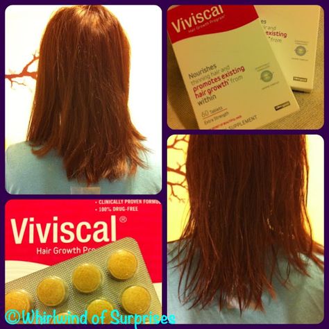 Prevent hair loss and treat thinning hair with Viviscal + Giveaway! Viviscal Before And After, Treat Thinning Hair, Skincare Review, Thinning Hair, Food Cooking, Natural Supplements, Beauty Skincare, Travel Food, Hair Growth