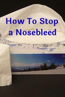 Learn the best ways to stop a nosebleed. How To Stop A Nose Bleed Fast, Nose Bleeds Remedies, Stop Nose Bleeds, Natural Nose, Stop Sneezing, Medical Remedies, High Blood Sugar Symptoms, Parts Of The Nose, Nose Bleeds