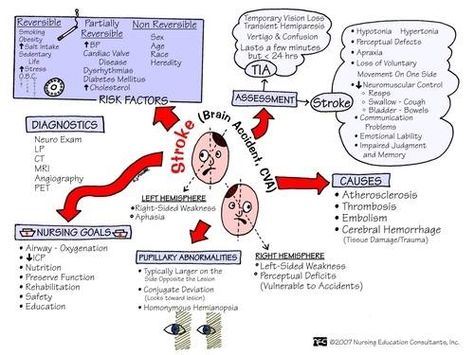 Stroke Nursing Neuro, Respiratory Problems, Med Surg Nursing, Nursing Mnemonics, Cardiac Nursing, Nurse Rock, Nursing School Studying, Nursing School Notes, Med Surg