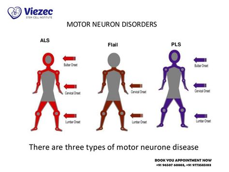 Motor Neurone Disease, Motor Neuron, Medical Health Care, Stem Cell Therapy, Medical Health, Neurology, Stem Cells, Chronic Illness, The Brain