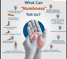 How can we stop numbness? Numbness is usually caused by nerve damage or lack of blood supply to a part of the body. Yoga poses such as neck stretches, back stretches – help to reduce numbness & restore the blood supply Going Numb, Tingling Hands, Arm Numbness, Swollen Hands, Nerve Pain Remedies, Carpel Tunnel, Numbness In Hands, Leg Ulcers, Body Outline