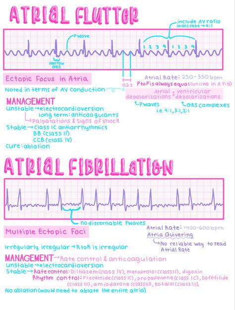 Ekg Notes Nursing Students, Ems Study Notes, Paramedic School Notes, Ekg Notes, Ekg Interpretation Made Easy, Medical Study Notes, Ekg Nursing, Ekg Tech, Physician Assistant School