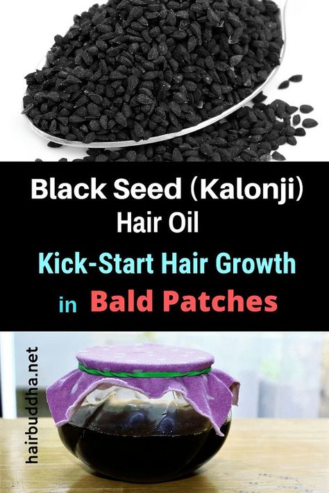 Black Seed Oil Benefits Hair, Aspirin For Hair, Kalonji Seeds, Seeds Benefits, Black Cumin, Bald Patches, Ayurvedic Hair, Overnight Beauty, Hair Growing