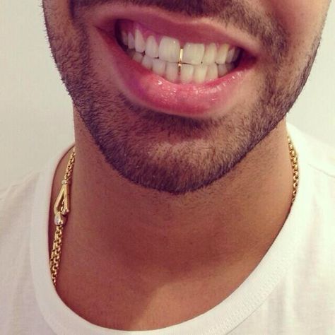 Drakes teeth.. Gap Grillz, Open Face Grillz, Mouth Grills, Girl Grillz, Grillz Teeth, Gold Grill, Diamond Teeth, Gold Grillz, Gap Teeth