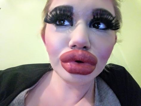 Woman Quadruples Her Lips To Have ‘Biggest In The World’ Huge Lips Injections, Huge Lip Fillers, Full Lips Natural, Full Lips Makeup, Overlined Lips, Pout Face, Big Eyelashes, Woman Lips, Eyebrow Slits