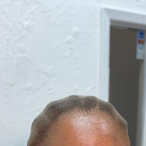 Travel Hairstylist on Instagram: "A bald cap application is the start of a fireeeeeee install 😩😳🥰🥰🥰🥰🥰🥰" Bald Cap, The Start, Instagram A, Hair Stylist, Travel, On Instagram, Instagram