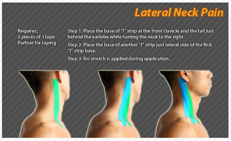 Sports Taping, Cervical Instability, K Tape, Text Neck, Kt Tape, Forward Head Posture, Kinesio Taping, Conditioning Workouts, Kinesiology Taping