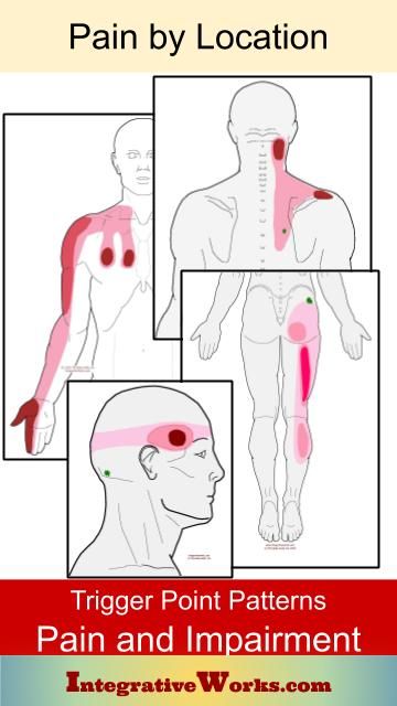 Trigger Point Patterns of Pain and Impaired Function | Integrative Works Shoulder Trigger Points, Punkty Spustowe, Trigger Point Release, Neck And Shoulder Exercises, Referred Pain, Middle Back Pain, Trigger Point Therapy, Cupping Therapy, Trigger Point