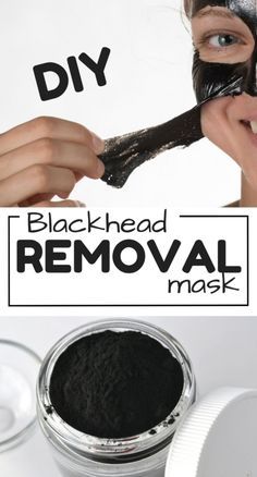 DIY Blackhead removal mask to get rid of blackheads most effectively Mask For Blackheads, Blackhead Removal Mask, Face Mask For Blackheads, For Blackheads, Black Head Remover Mask, Blackheads On Nose, Rid Of Blackheads, Cold Sores Remedies, Blackhead Removal