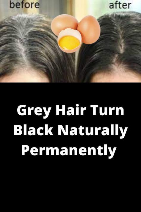 The best natural recipe for gray hair Homemade Hair Growth Serum, Remedies For Healthy Hair, Dyed White Hair, Diy Hair Ideas, Hair Problems Solutions, Grow Hair Overnight, Homemade Hair Growth, Gray Hair Solutions, Black And Grey Hair