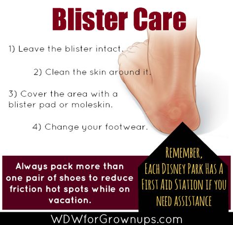 First Aid For Friction Blisters And What You Should Know How To Heal Blisters, Blister Care, Heel Blisters, Disney Planning, Healthy Pets, Life Hack, Life Time, First Aid, Pet Dog