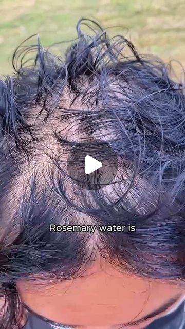 Rosemary Oil Recipe, Rosemary Water, Rosemary Oil For Hair, How To Grow Your Hair Faster, Hair Growing Tips, Bald Hair, Skin Care Order, Hair Control, Rosemary Oil