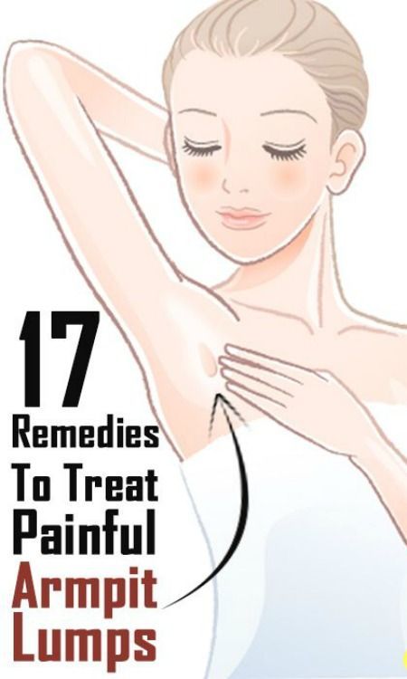 Given here are easy to do home remedies that one can follow or do at home to treat painful lumps in the armpit without any additional expense or worry about side effects. Lump In Armpit, Armpit Lump, Small Bumps On Face, Lump Behind Ear, Skin Bumps, Serious Illness, Lymph Nodes, Under My Skin, Design Lighting