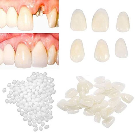 Denture Repairs, Broken Teeth, Tooth Crown, Tooth Filling, Temporary Tooth, Tooth Repair, Veneers Teeth, False Teeth, Fake Teeth