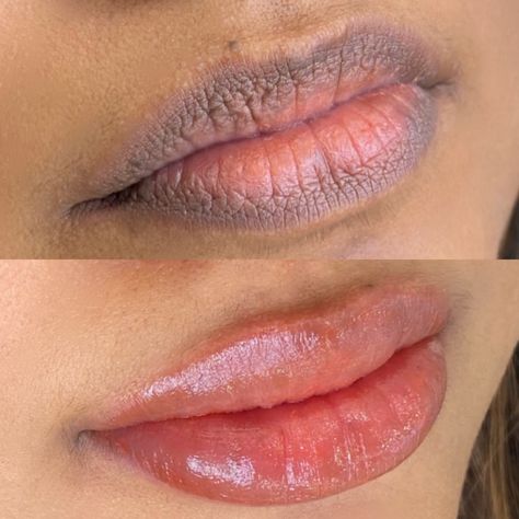 Dark lip correction with lip blush tattoo Lip Tint Tattoo, Cosmetic Lip Tattoo, Lip Blush Tattoo, Bb Lips, Blush Tattoo, Lip Blushing, Lip Lightening, Esthetician School, Dark Lip