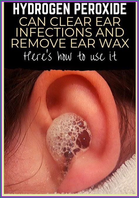 Hydrogen Peroxide Can Clear Ear Infections and Remove Ear Wax � Here�s How to Use it Cleaning Your Ears, Ear Infections, Ear Wax Removal, Organic Remedy, Ear Wax, Nail Fungus, Ear Cleaning, Hydrogen Peroxide, Organic Health