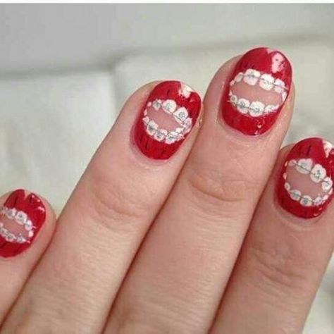 Cool dental Art photos | Dental art: Ortho nails - DentistryIQ Dental Fun, Nail Art Photos, Dental Facts, Dental Art, Dental Humor, Pediatric Dentistry, Dental Hygienist, Dental Assistant, Dental Hygiene