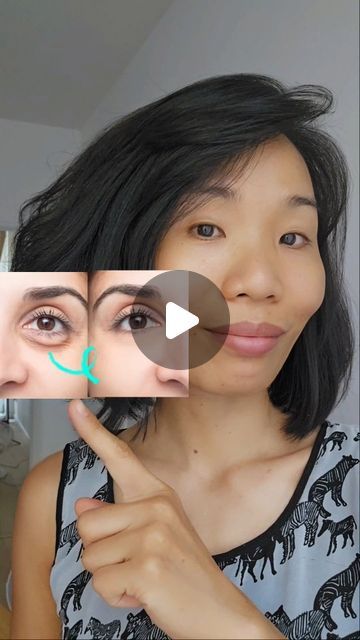 Under Eye Bag Exercises, Eye Wrinkles, Eye Exercises, Under Eye Wrinkles, Face Exercises, Be Consistent, Yoga Facial, Facial Exercises, Eye Wrinkle