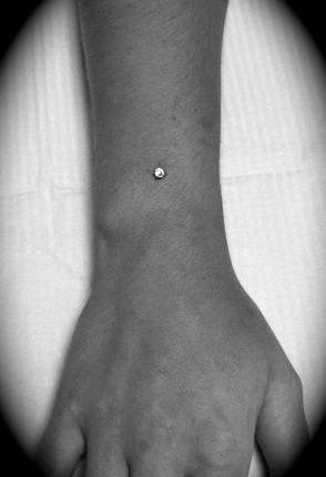 micro dermal anchor by:Nick Shipley www.bodymodsbynick.com Dermal Anchor, Mandala Lotus, Dermal Piercing, Body Modifications, Tattoos And Piercings, Classy Outfits, Belly Button Rings, Muse, Piercings