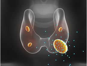 Parathyroid Symptoms, Parathyroid Hormone, Parathyroid Disease, Memory Problems, Hormone Replacement, Body Ache, Nursing Notes, Blood Test, Cardiovascular Disease