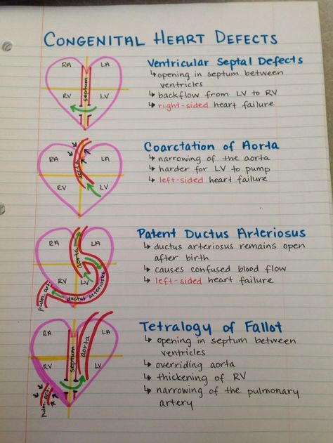 Congenital Heart Defects #NCLEXprep #NursingStudent Penyakit Jantung, Nursing Mnemonics, Medical Student Study, Cardiac Nursing, Nursing School Survival, Congenital Heart, Nursing School Studying, Nursing School Tips, Nursing School Notes