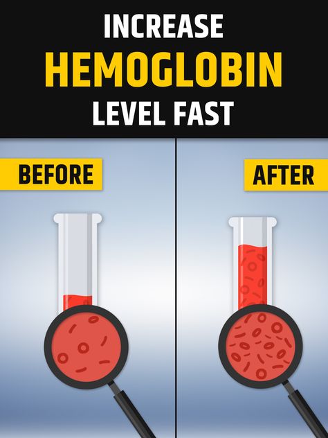 Hb.145 How To Increase Hemoglobin, Increase Hemoglobin Fast, How To Increase Hemoglobin Level, Hemoglobin Increase Food, Hemoglobin Levels, Red Blood, Red Blood Cells, Blood Cells, The Body